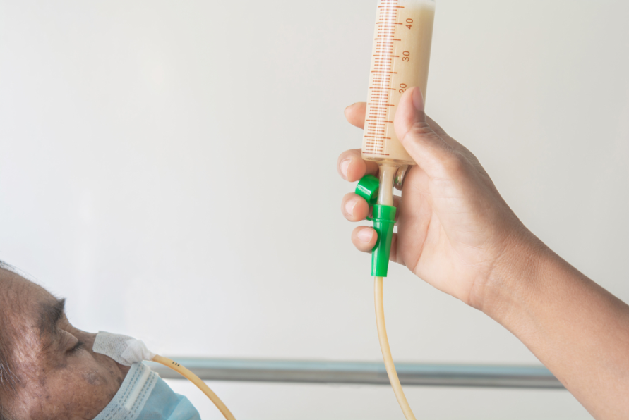 Tube Feeding: What Every Family Should Know