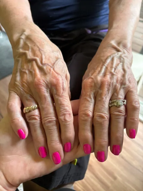 Resident showing a colorful pink manicure at AAA Shepherd’s Care Home